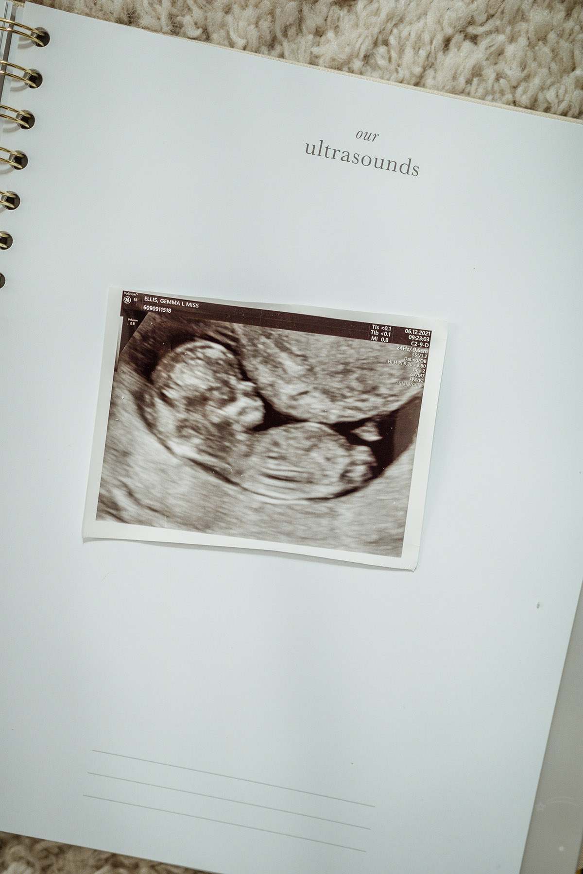 pregnancy baby number two 12 week scan