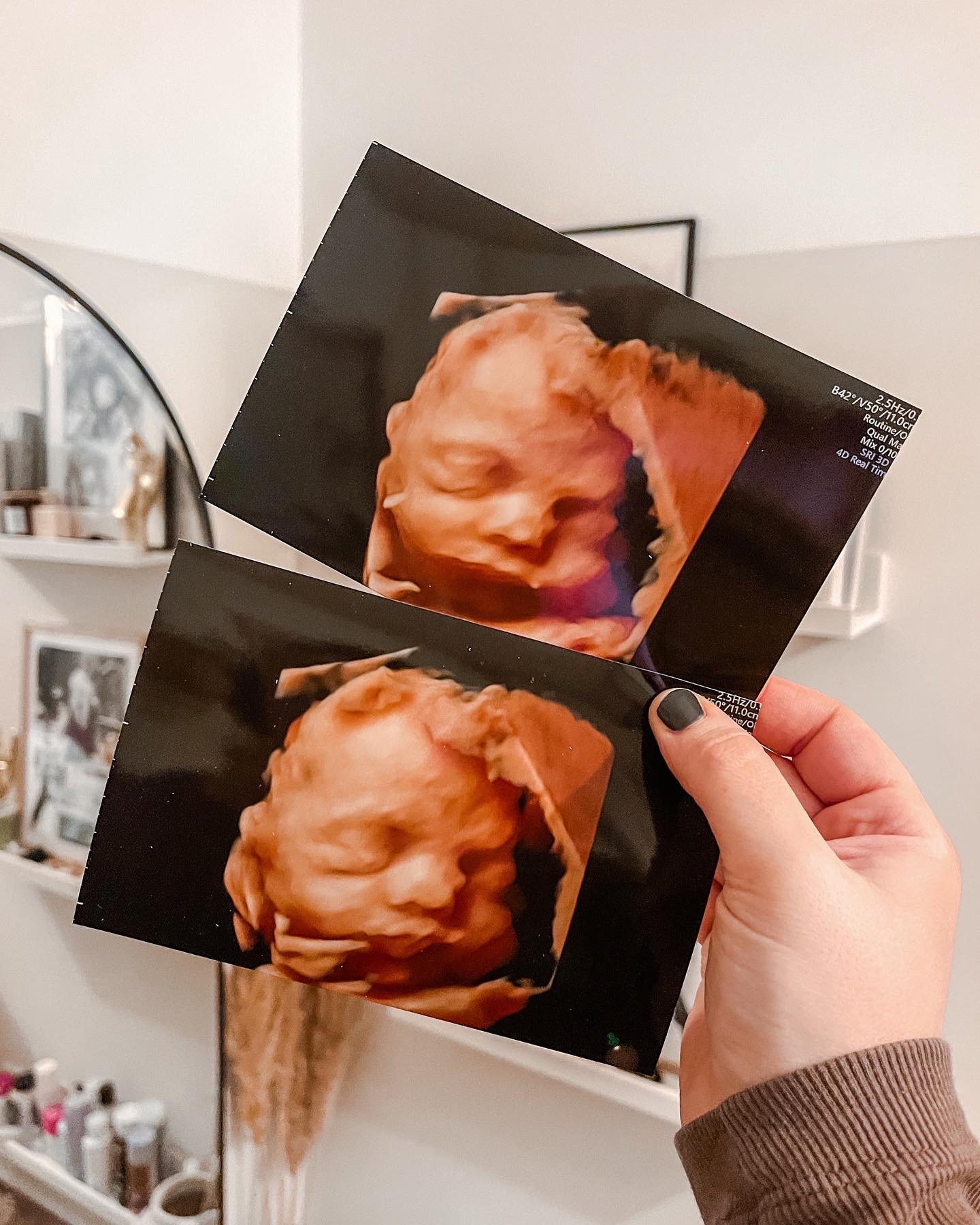 pregnancy the third trimester blog update 4d scan